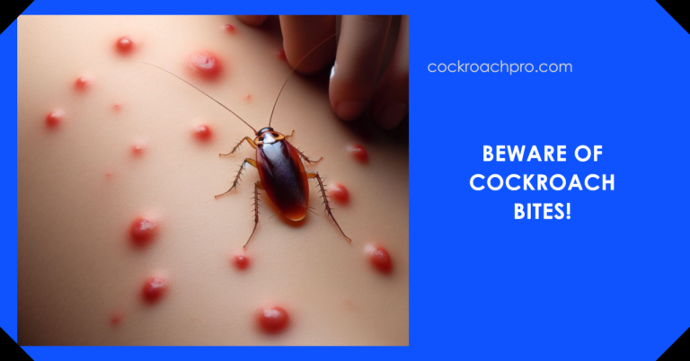 do cockroaches bite?