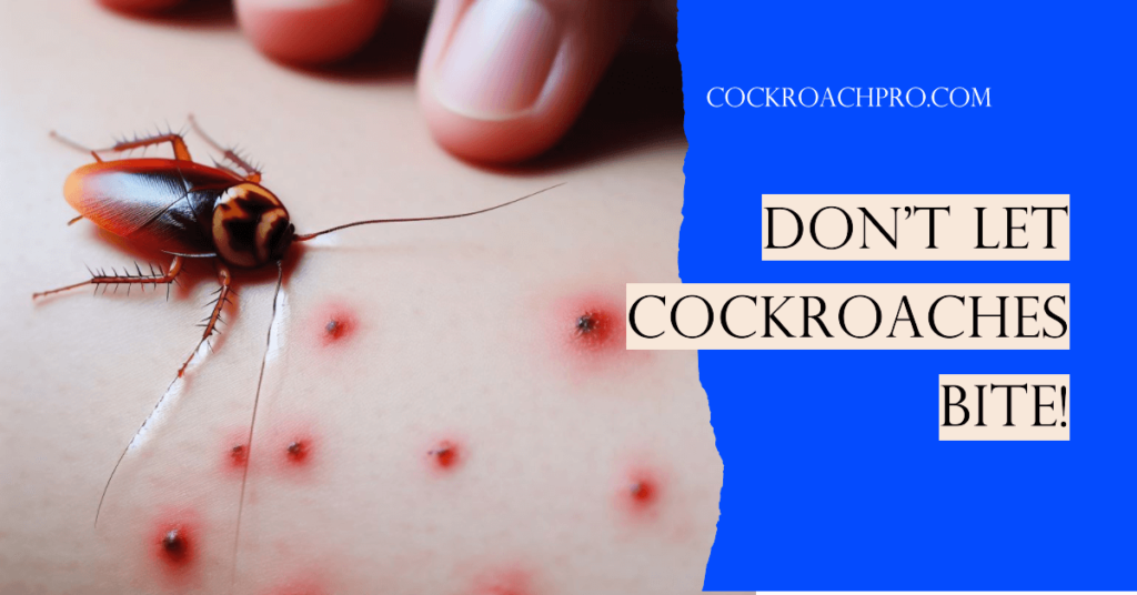 do cockroaches bite